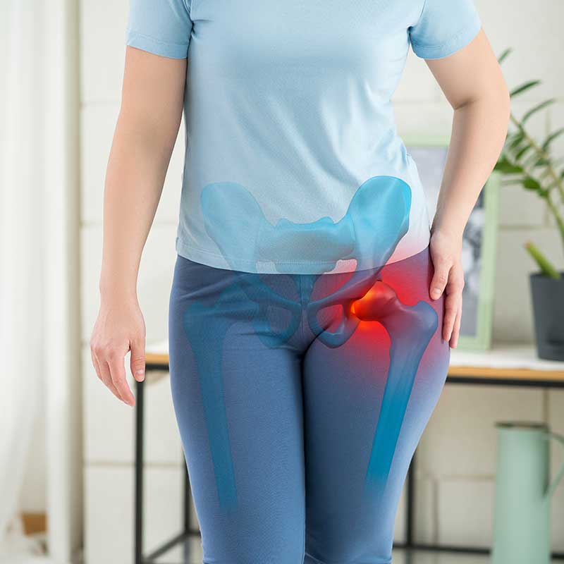 Hip Osteoarthritis Causes, Symptoms Diagnosis and Treatments